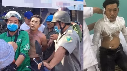 Kẻ cướp ngân hàng ... tự hại mình