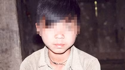 Những đứa trẻ bị "giời hành" ở Hà Giang