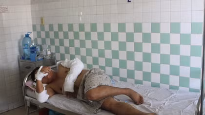 Nổ thiết bị trong nhà máy gạch, 4 người bị bỏng