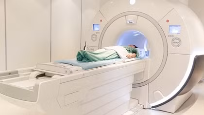 Đột quỵ não và vai trò của chụp cộng hưởng từ (MRI) trong tầm soát đột quỵ