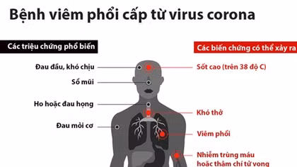 Bình Dương họp khẩn ứng phó virus Corona