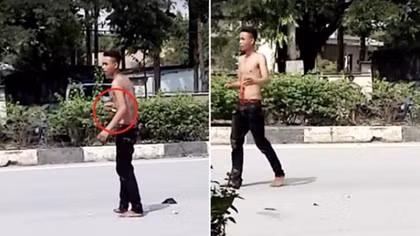 Nam thanh niên nghi “ngáo đá” tự đâm xổ ruột giữa đường