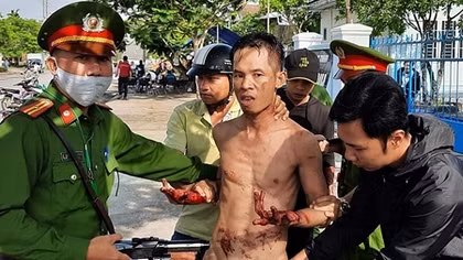 Khống chế kẻ nghi ngáo đá dùng dao tự thương