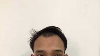 Đạo chích nghiện 2 tiền án vừa ra tù gây 6 vụ trộm