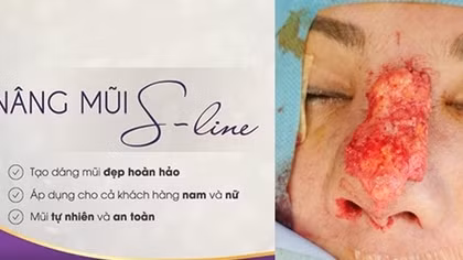 Cái kết cực đắng cho việc làm đẹp không đúng cách