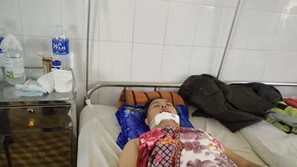 Một Công an viên bị thương khi truy bắt trộm xe máy