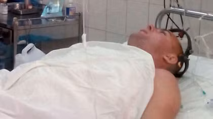 Phẫu thuật cấp cứu du khách Nga bị sóng biển xô đập chấn thương cột sống cổ