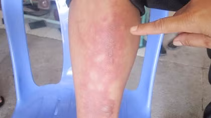 Giang hồ ném chai xăng tự chế, truy sát 1 gia đình