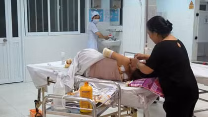 Hai vợ chồng bỏng nặng khi vừa từ ‘nhà ngoại về’