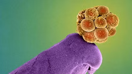 Crispr-Cas9: Công nghệ “biên tập lại” bộ gene phôi thai người