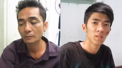 Dũng cảm bắt cướp, một bảo vệ dân phố bị thương
