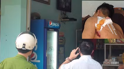 3 thanh niên thương vong trong vụ tấn công trước cửa phòng trọ