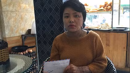  Bé gái bị bỏng trong vụ cháy chợ Phùng Khoang mưu sinh bằng bán bánh mì