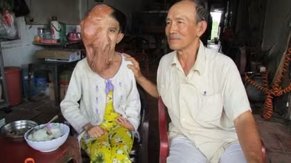 Nghị lực và lòng hiếu thảo của cô gái tật nguyền