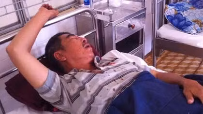 Rủ nhau ném đá xe khách, một đối tượng bị phạt 4 năm tù