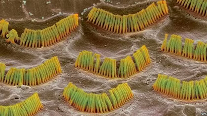 Liệu pháp virus cho người khiếm thính