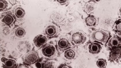 Virus biến đổi gene chống ung thư