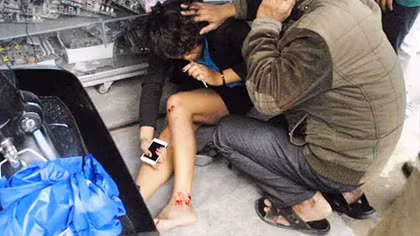 Đà Lạt: Cô gái đuổi theo hai tên cướp bị tai nạn