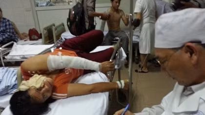 Nổ lớn tại công ty sản xuất gỗ, nhiều công nhân bị bỏng nặng