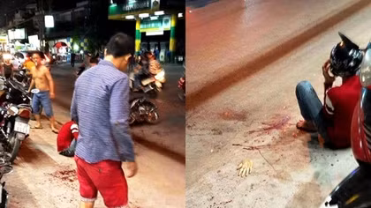 Khởi tố vụ chém người lìa bàn tay trên phố 