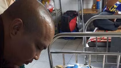 Bé 4 tuổi bị bỏng ở nhóm trẻ gia đình