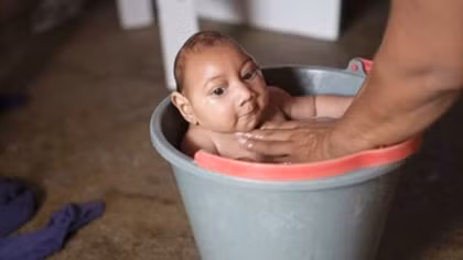 Chỉ xét nghiệm virus Zika khi có chỉ định