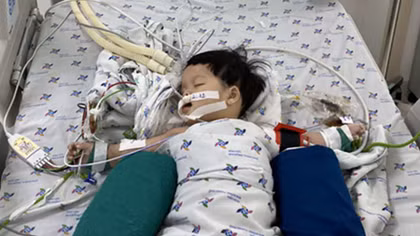 Bé gái suýt mất mạng vì hóc xương lươn