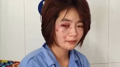 Khởi tố vụ án nhóm đối tượng hành hung nữ nhân viên xe buýt
