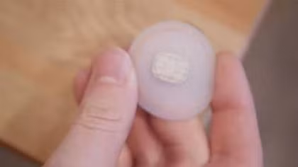 Phẫu thuật cấy chip vào cơ thể ngày càng phổ biến