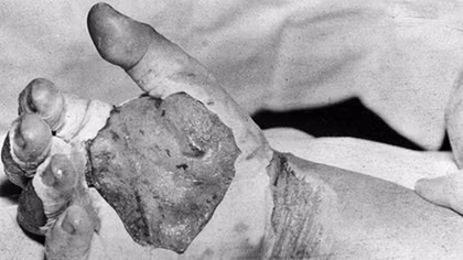 Bí mật xung quanh chương trình hạt nhân của Hitler