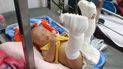Để không còn nạn bạo hành trẻ em