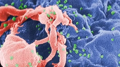 Sắp có chủng ngừa virus HIV?
