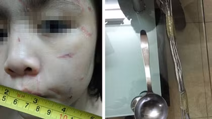 Đau lòng chuyện "bánh đúc có xương"