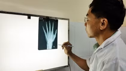 Xác định tuổi qua giám định xương: Nút thắt những vụ án