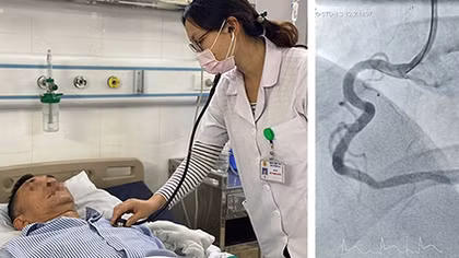 Cứu sống hai bệnh nhân nhồi máu cơ tim biến chứng nặng