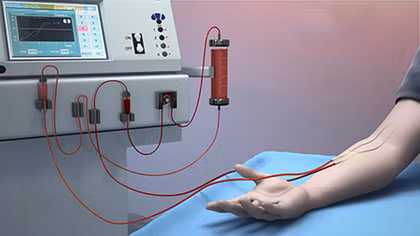 Yêu cầu các đơn vị chấn chỉnh qui trình chạy thận nhân tạo