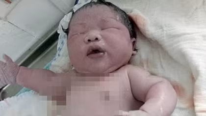 Bé trai khổng lồ ở Vĩnh Phúc chào đời nặng 7,1kg