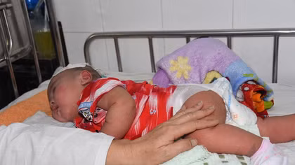Chống dịch sởi, lập phòng tiêm "vét" tại các Bệnh viện 