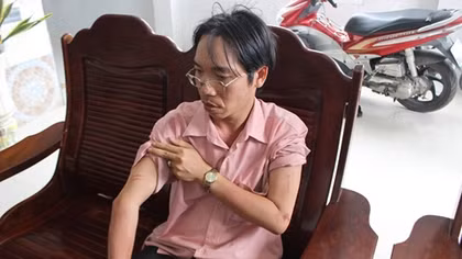 Dùng roi điện tấn công chủ tiệm vàng, cướp đoạt hơn 2 tỷ đồng