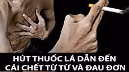 Thuốc lá – thủ phạm âm thầm phá hủy trái tim