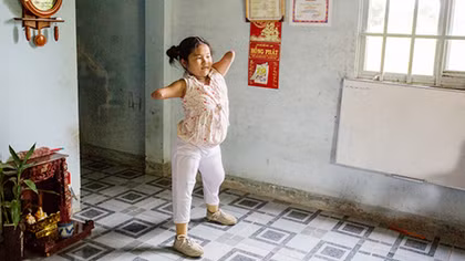 Nghẹn lòng xem cuộc sống hàng ngày của cô bé không tay chân