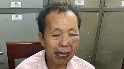 “Trùm” ma túy dùng súng và dao nhọn tấn công Cảnh sát