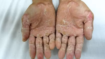 Phát hiện người mẹ mang bầu và con bị "bệnh lạ"