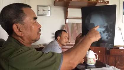 Bị thương gần nửa thế kỷ chưa được hưởng chế độ thương binh