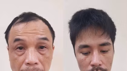 Từ vụ trộm 2 xe máy ra 9 vụ trộm tài sản khác