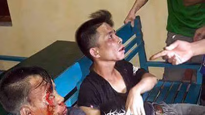 Đối tượng trộm chó giả chết tránh đòn khi bị dân vây bắt