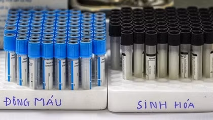 Khoảng 18,3 triệu người được ưu tiên tiêm vaccine COVID-19 