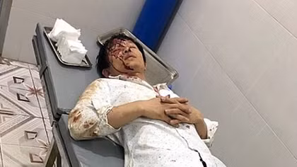 Đi đòi tiền, chủ nợ bị đánh trọng thương