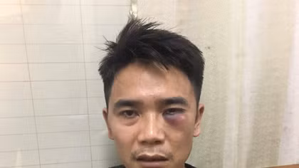 Nghiện ma túy, mang theo dùi cui điện đi trộm cắp tài sản