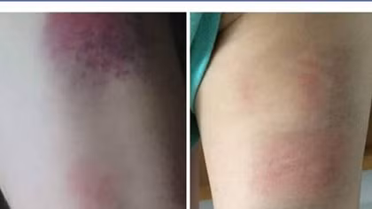 Giáo viên dùng thước đánh 22 học sinh, Bộ GD&ĐT nói gì?